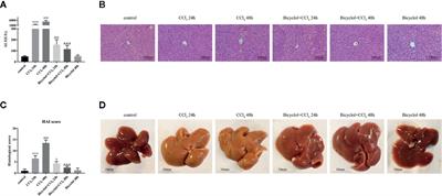 Bicyclol Attenuates Acute Liver Injury by Activating Autophagy, Anti-Oxidative and Anti-Inflammatory Capabilities in Mice